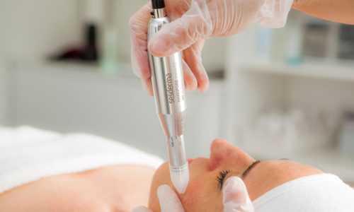 Microneedling – Nanopore tratamientos faciales pilar de la horadada