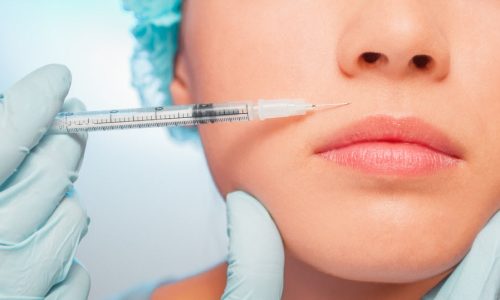 estetica-labios arrugas peribucales clinica medicina estetica pilar de la horadada